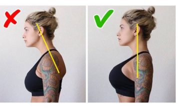 STVORILA VAM SE GRBA NA VRATU? EVO KAKO ĆETE JE ISPRAVITI: Trebate samo slediti ovih 5 saveta!