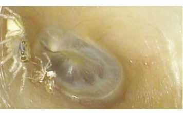 SVRBELO JE UVO DO BESVESTI, OTIŠLA U BOLNICU, A TAMO ŠOK: Kada su videli šta je unutra nisu mogli da veruju svojim očima! (FOTO)