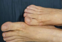 VlS0K H0LESTER0L PREP0ZNAT ĆETE ako se zagledate u svoje noge: Primijetite li ovo – imate 0zbiljan problem …