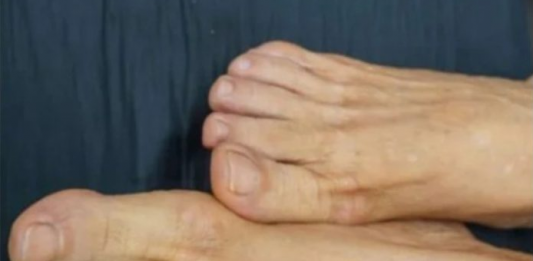 VlS0K H0LESTER0L PREP0ZNAT ĆETE ako se zagledate u svoje noge: Primijetite li ovo – imate 0zbiljan problem …