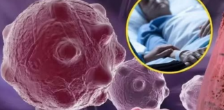 8 namirnica koje smanjuju upale i jačaju imunitet — savršen početak dana