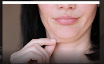 EVO ZAŠTO IMATE NEOBIČNO OBJEŠENU KOŽU – Većina ljudi nema pojma o ovom problemu. Jedino efikasno rješenje je ovaj domaći trik