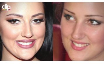 KAD SU SKUPILI PARE, URADILI SU ZUBE: POGLEDAJTE kako su izgledale domaće ličnosti PRIJE UMJETNIH ZUBA – CECA JE HIT (FOTO)