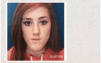 TETKA IZ AMERIKE MI POSLALA PARE ZA PLASTIČNU OPERACIJU: Kad sam joj poslala sliku VRISNULA OD ŠOK, SAD SAM …