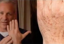 Sok od luka + jabukovo sirće: Samo pomiješajte i riješite se staračkih pjega narukama, licu i dekolteu jednom za svagda!