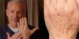 Sok od luka + jabukovo sirće: Samo pomiješajte i riješite se staračkih pjega narukama, licu i dekolteu jednom za svagda!