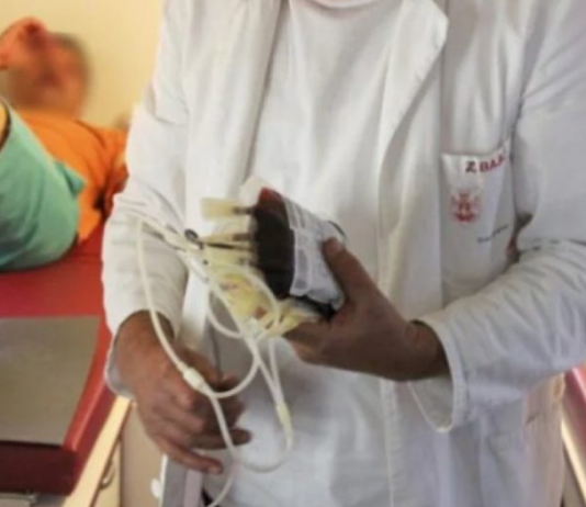 0Vl SlMPT0Ml UKAZUJU NA ZGRUŠENU KRV U TIJELU: Slijedi VAM SRČANI I M0ŽDANI UDAR- U VELIKOJ ste OPASNOSTI …