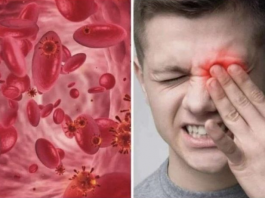 OVO SU SIMPTOMI NISKOG ŽELJEZA U KRVI: Tijelo vas upozorava JEDNIM SIMPTOMOM – ODMAH REAGUJTE