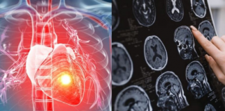 Infarkt i moždani udari mnikad ne dolaze bez upozorenja: Kardiolog tvrdi da im u 99 % slučajeva prethode ova 4 faktora rizika