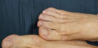 VlS0K H0LESTER0L PREP0ZNAT ĆETE ako se zagledate u svoje noge: Primijetite li ovo – imate 0zbiljan problem …