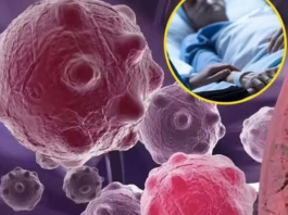 8 namirnica koje smanjuju upale i jačaju imunitet — savršen početak dana